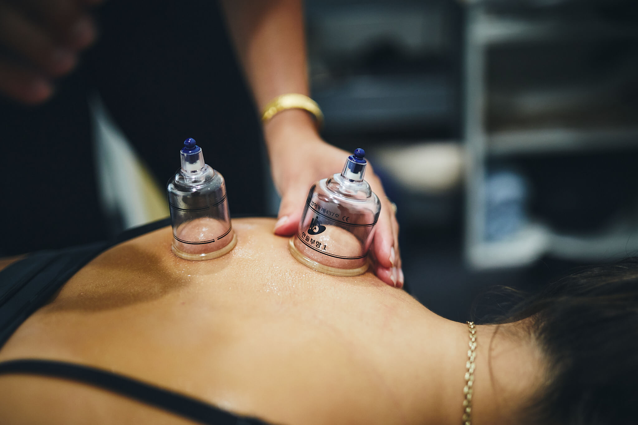 cupping service sydney